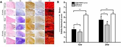 Demineralized Cortical Bone Matrix Augmented With Peripheral Blood-Derived Mesenchymal Stem Cells for Rabbit Medial Meniscal Reconstruction